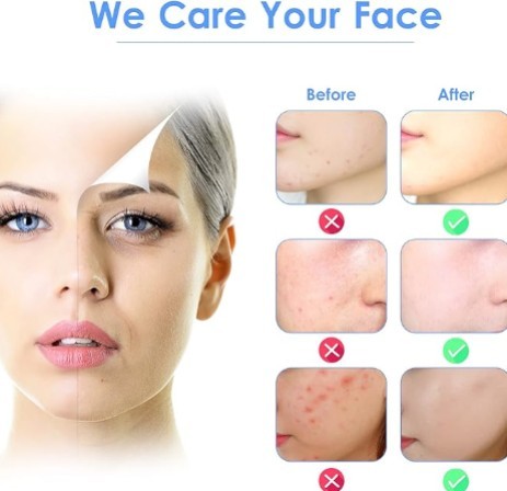 3-in-1 Ultrasonic Facial Skin Scrubber